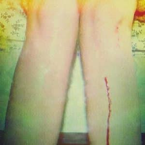 Los Campesinos - Romance Is Boring, 10th Anniversary Remaster (Vinyl 2xLP, Gold)